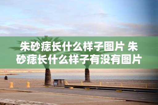 朱砂痣长什么样子图片 朱砂痣长什么样子有没有图片可以参考
