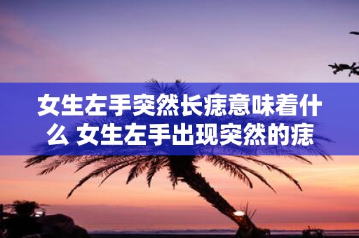 女生左手突然长痣意味着什么 女生左手出现突然的痣这意味着什么