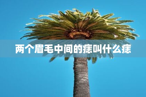 两个眉毛中间的痣叫什么痣