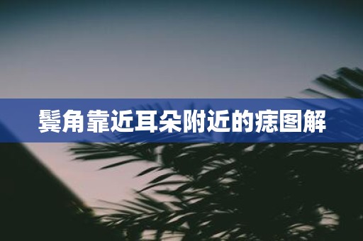 鬓角靠近耳朵附近的痣图解