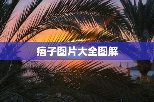 痦子图片大全图解