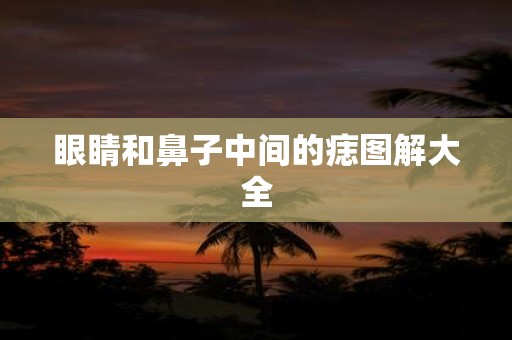 眼睛和鼻子中间的痣图解大全