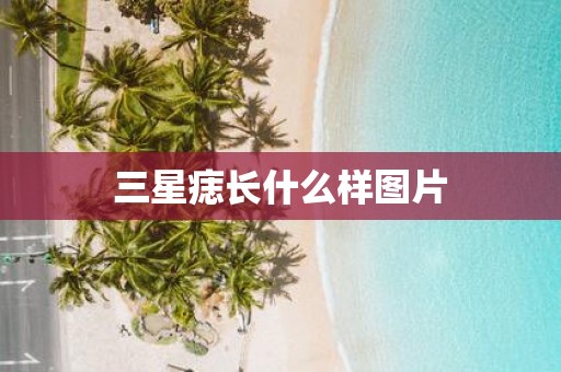 三星痣长什么样图片