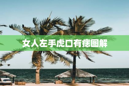 女人左手虎口有痣图解