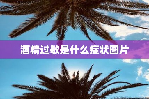 酒精过敏是什么症状图片