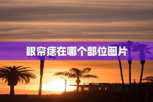 眼帘痣在哪个部位图片