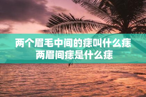 两个眉毛中间的痣叫什么痣 两眉间痣是什么痣