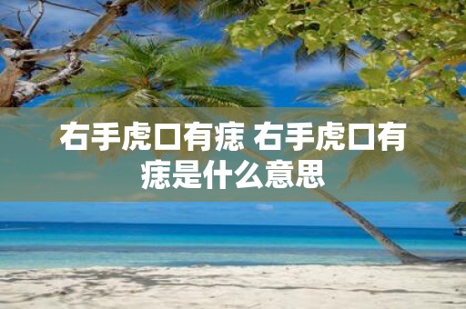 右手虎口有痣 右手虎口有痣是什么意思