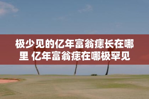 极少见的亿年富翁痣长在哪里 亿年富翁痣在哪极罕见