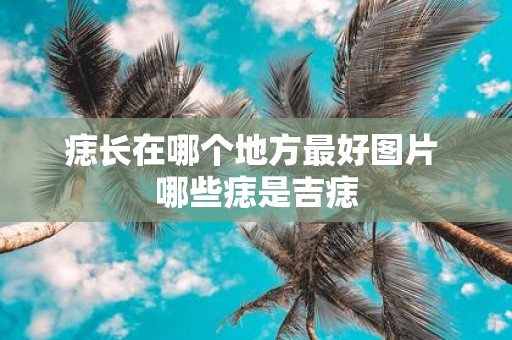 痣长在哪个地方最好图片 哪些痣是吉痣