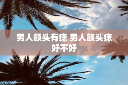 男人额头有痣 男人额头痣好不好
