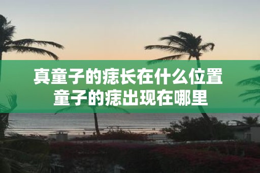 真童子的痣长在什么位置 童子的痣出现在哪里