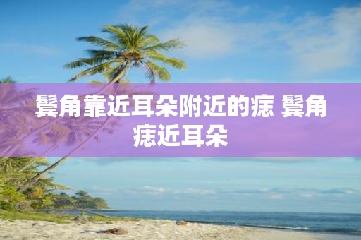 鬓角靠近耳朵附近的痣 鬓角痣近耳朵