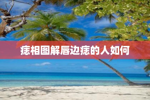 痣相图解唇边痣的人如何