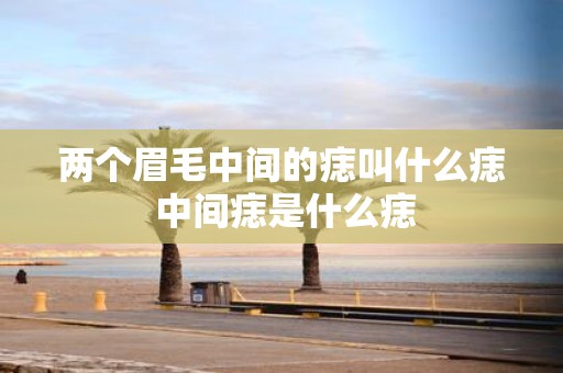 两个眉毛中间的痣叫什么痣 中间痣是什么痣