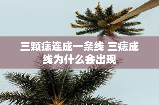 三颗痣连成一条线 三痣成线为什么会出现