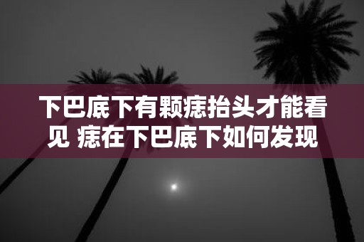 下巴底下有颗痣抬头才能看见 痣在下巴底下如何发现