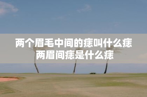 两个眉毛中间的痣叫什么痣 两眉间痣是什么痣
