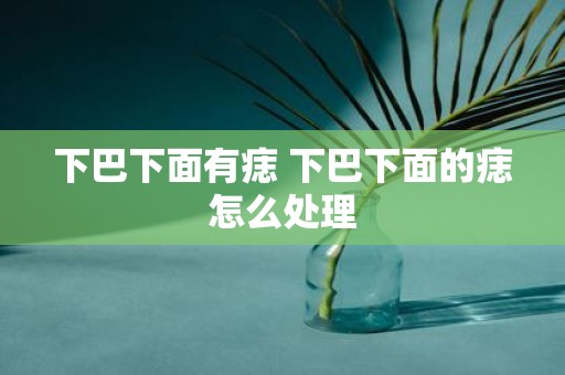 下巴下面有痣 下巴下面的痣怎么处理