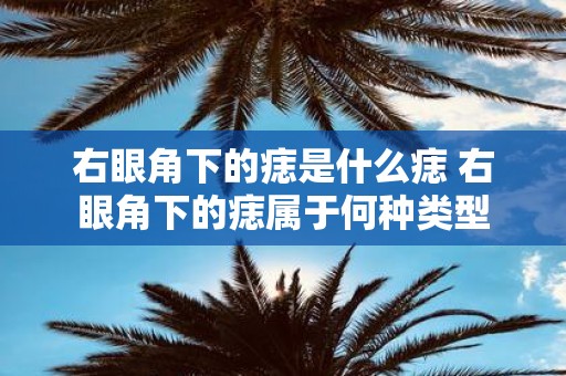 右眼角下的痣是什么痣 右眼角下的痣属于何种类型