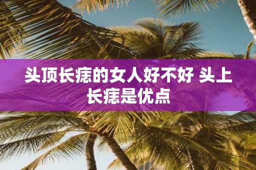 头顶长痣的女人好不好 头上长痣是优点