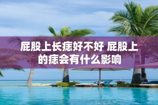 屁股上长痣好不好 屁股上的痣会有什么影响