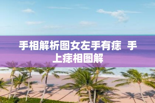 手相解析图女左手有痣 手上痣相图解