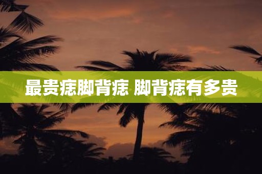 最贵痣脚背痣 脚背痣有多贵