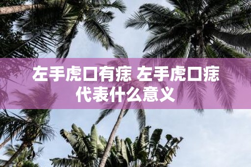 左手虎口有痣 左手虎口痣代表什么意义