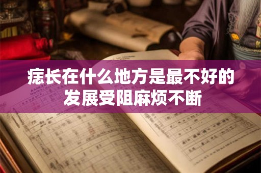 痣长在什么地方是最不好的 发展受阻麻烦不断