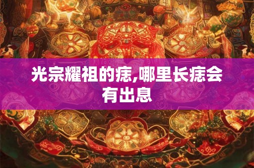 光宗耀祖的痣,哪里长痣会有出息