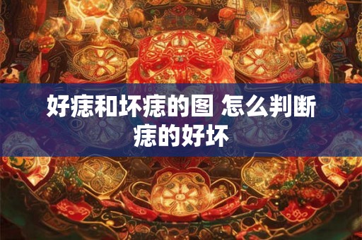 好痣和坏痣的图 怎么判断痣的好坏