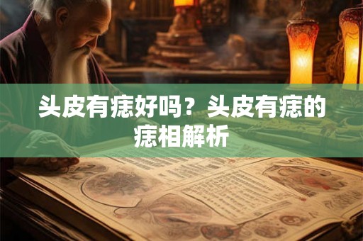 头皮有痣好吗？头皮有痣的痣相解析