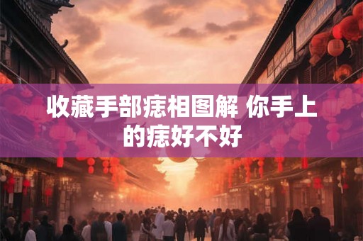 收藏手部痣相图解 你手上的痣好不好
