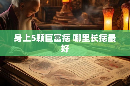 身上5颗巨富痣 哪里长痣最好
