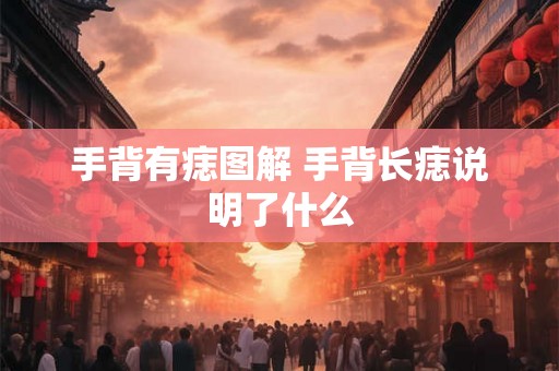 手背有痣图解 手背长痣说明了什么