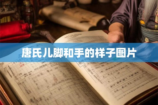 唐氏儿脚和手的样子图片