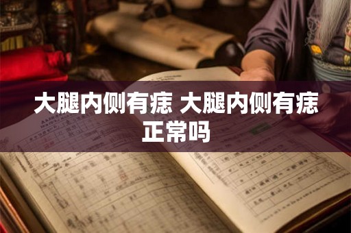 大腿内侧有痣 大腿内侧有痣正常吗