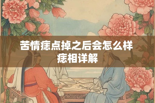 苦情痣点掉之后会怎么样 痣相详解 苦情痣点掉之后会怎么样 痣相详解