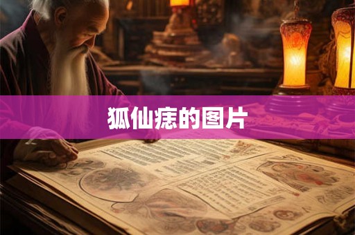 狐仙痣的图片 狐仙痣的图片