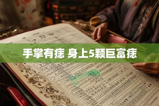 手掌有痣 身上5颗巨富痣