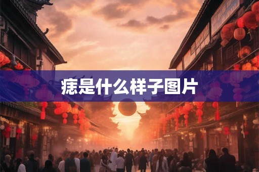 痣是什么样子图片